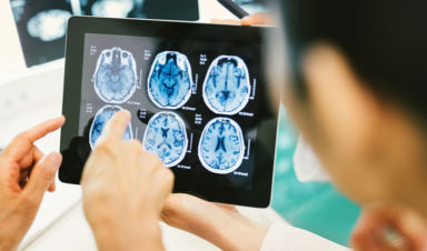 A doctor and patient review scans of the patient's brain, revealing a catastrophic head injury that requires a catastrophic injury attorney.