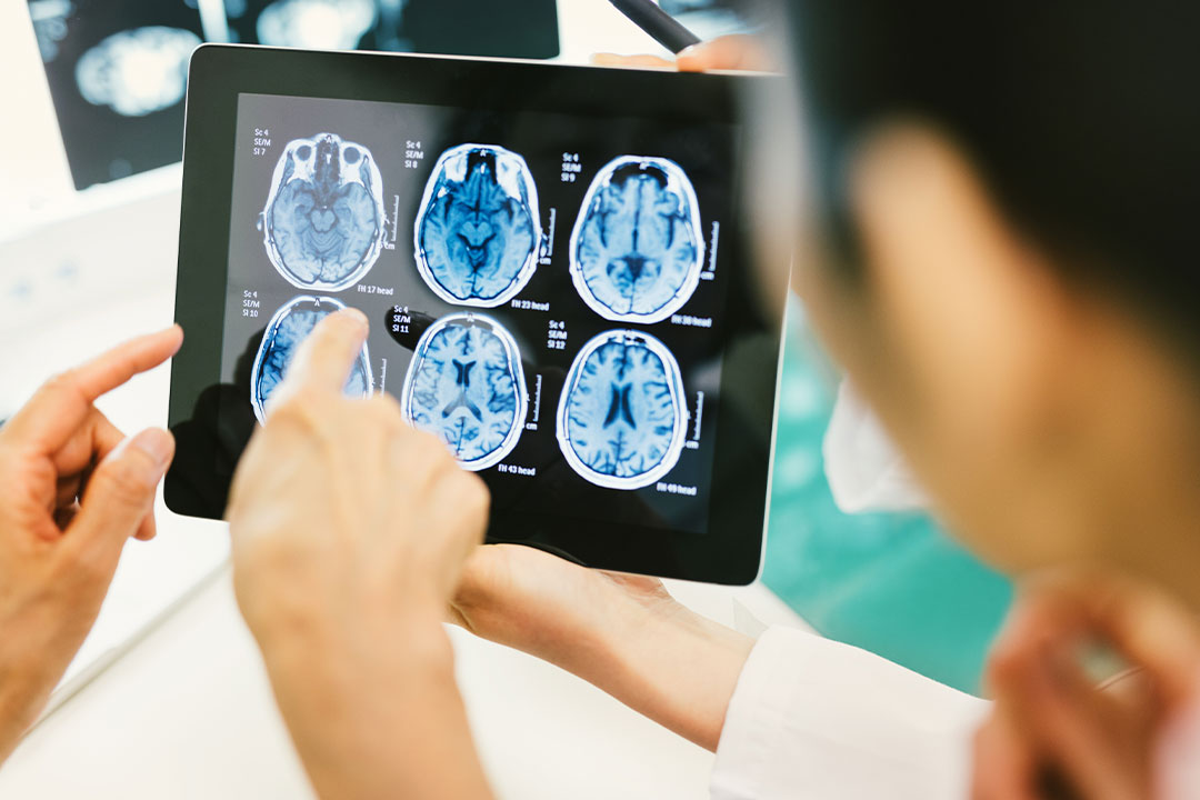 A doctor and patient review scans of the patient's brain, revealing a catastrophic head injury that requires a catastrophic injury attorney.